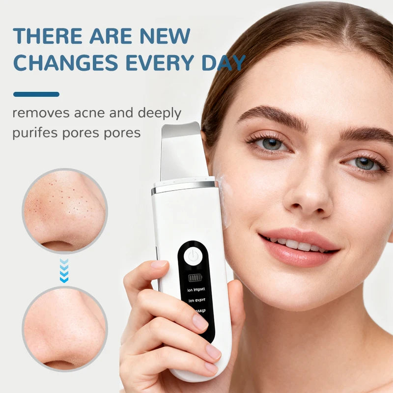 Lady Care Ultrasonic Skin Scrubber 4 in 1 Ion Import Export Facial Cleansing Spatula