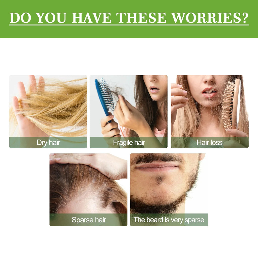Rosemary Hair Growth Oil Hair Care Thickness Loss Deep Nourishing Scalp Care Strengthen Repair Damaged Oil Control For Men Women