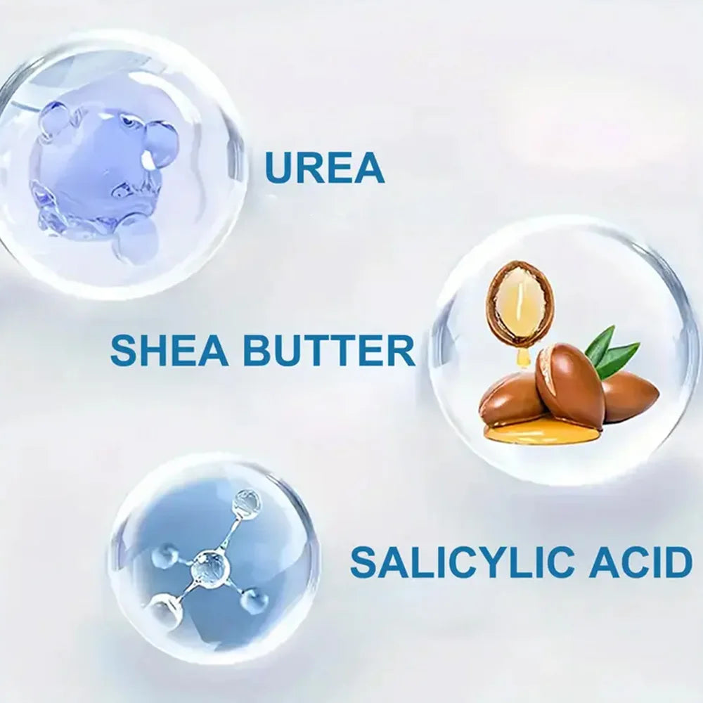 YOUNGCOME 250G Urea Cream with Salicylic Acid