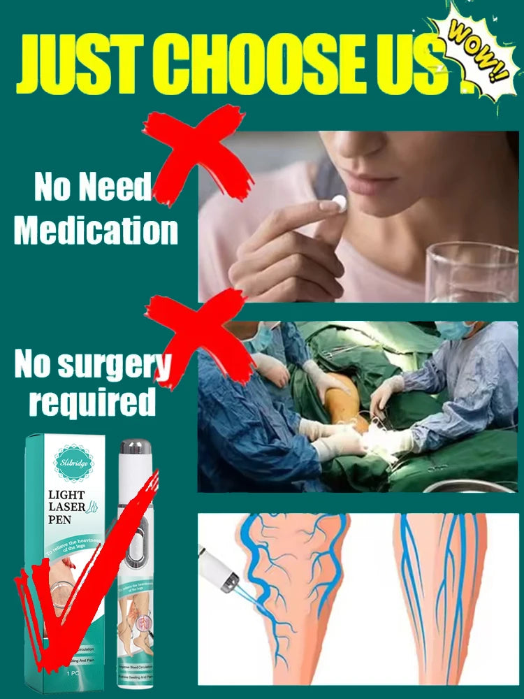 Blue Light Pen for Treating Veins in Both Legs, Vein Care Tool