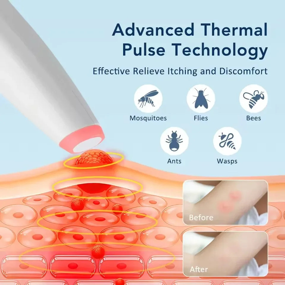 Portable Mosquito Bite Anti‑Itch Pen Insect Bite Healer