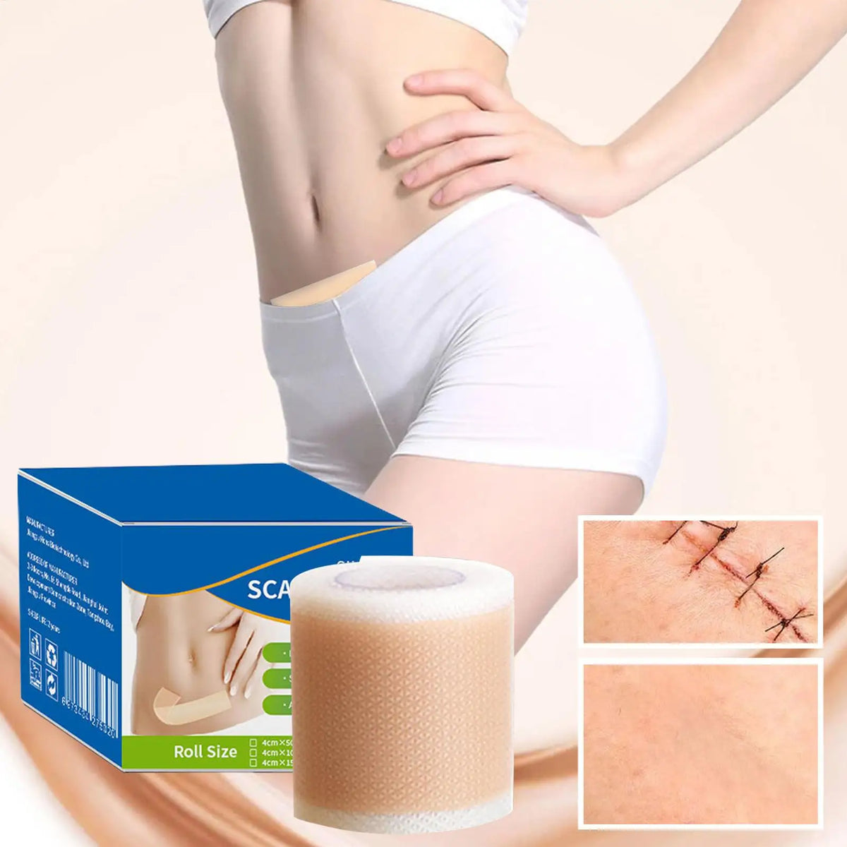 1 Roll Silicone Scar Sheets ,4cm X 50cm Silicone Scar Sheets