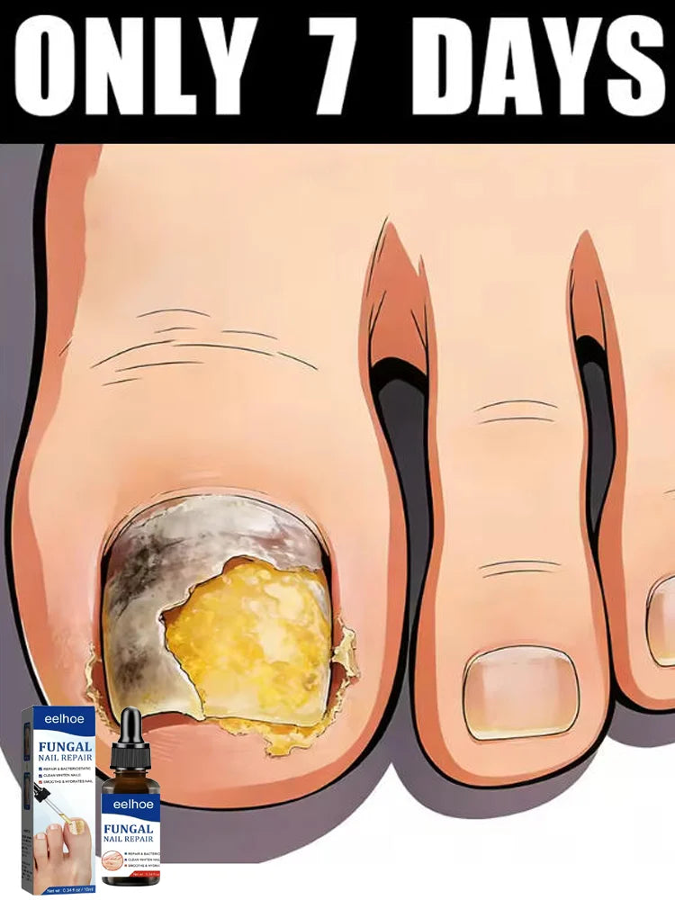 YTS Rejuvenator - Fungus Prevention Technology - Adjustable Temperature Control & Safety Sensor
