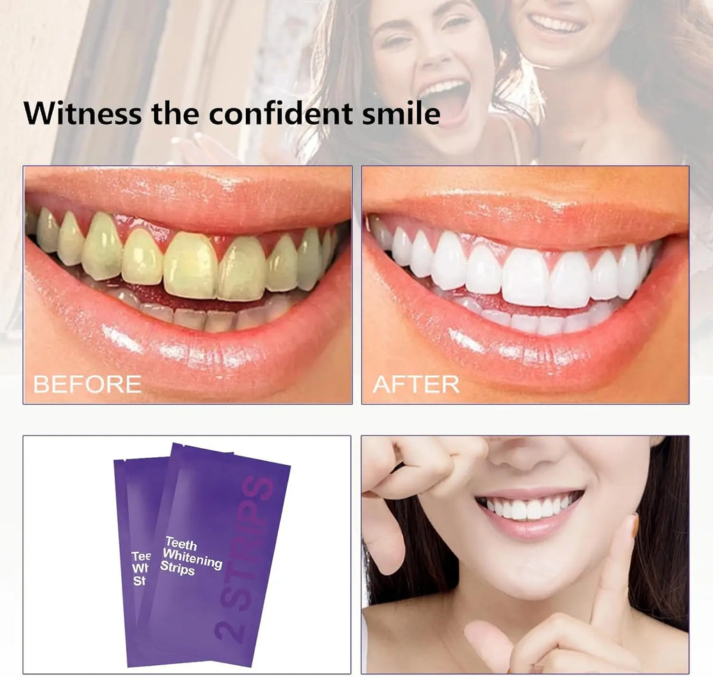 Purple Teeth Whitening Strips Kit Professional Stain Removal