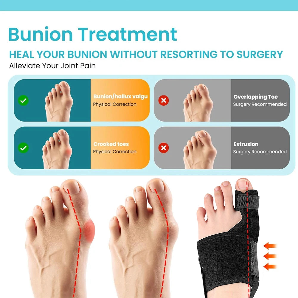 1/2PCS Bunion Corrector - Orthopedic Bunion Splint