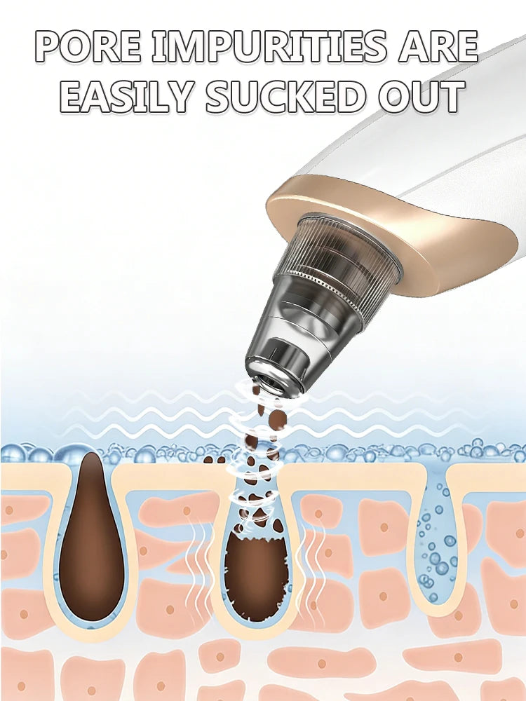 Facial Skin Care Pore Removal Cleanser Vacuum Black Spots Removal For Deep Facial Pores 5 Suction Power Blackhead Remover Pore