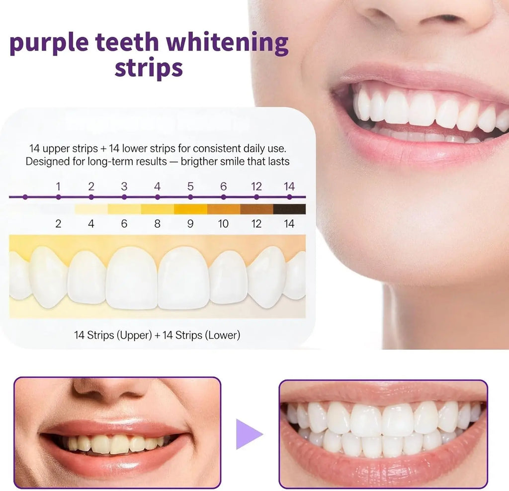 Purple Teeth Whitening Combo Kit – Stain Removing Strips & Colour-Correcting Serum 30-Min Fast Brightening