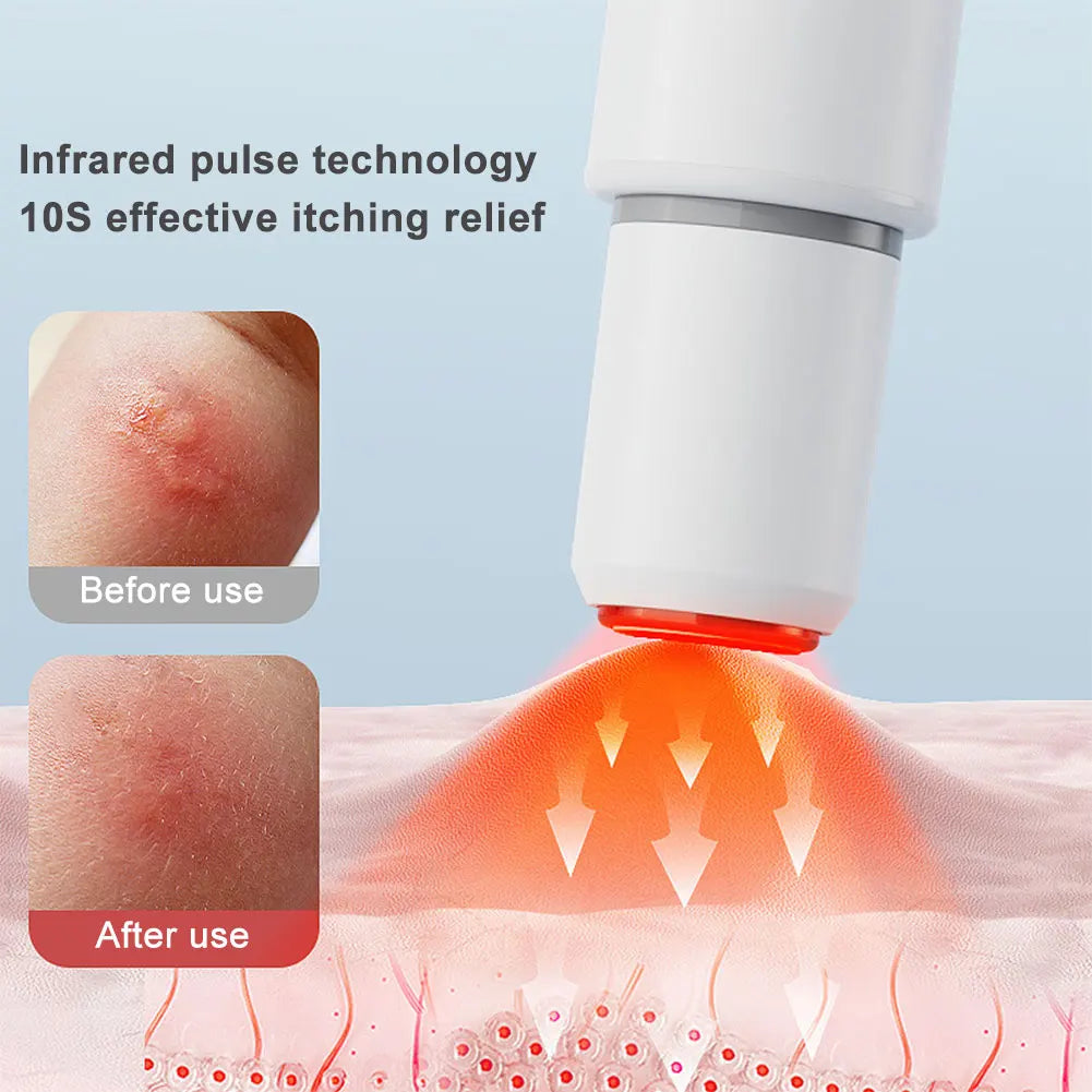 Electronic Mosquito Bite Pen Portable Mosquito Insect Bite