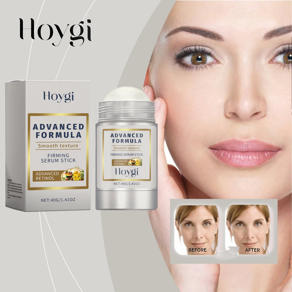 Hoygi 40g Retinol Renewal Stick Wrinkle Smoothing and Night Repair