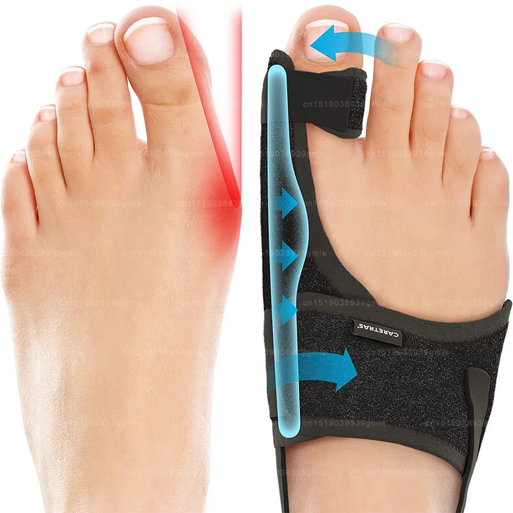Toe Corrector Orthotics Bone Thumb Adjuster Hammer Protector Hallux Valgus Corrector Bunion Corrector Orthopedic Tool Care Tools