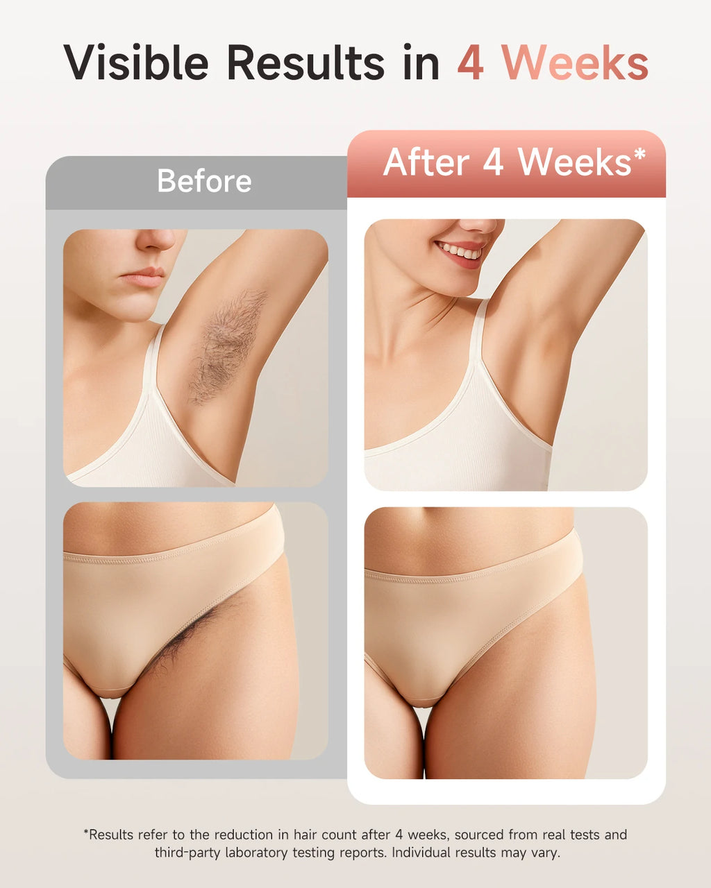 Unlimited Flashes IPL Hair Removal 9 Energy Levels Epiladora