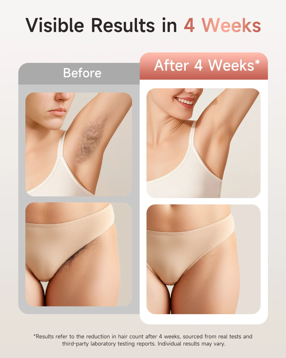 Unlimited Flashes IPL Hair Removal 9 Energy Levels Epiladora
