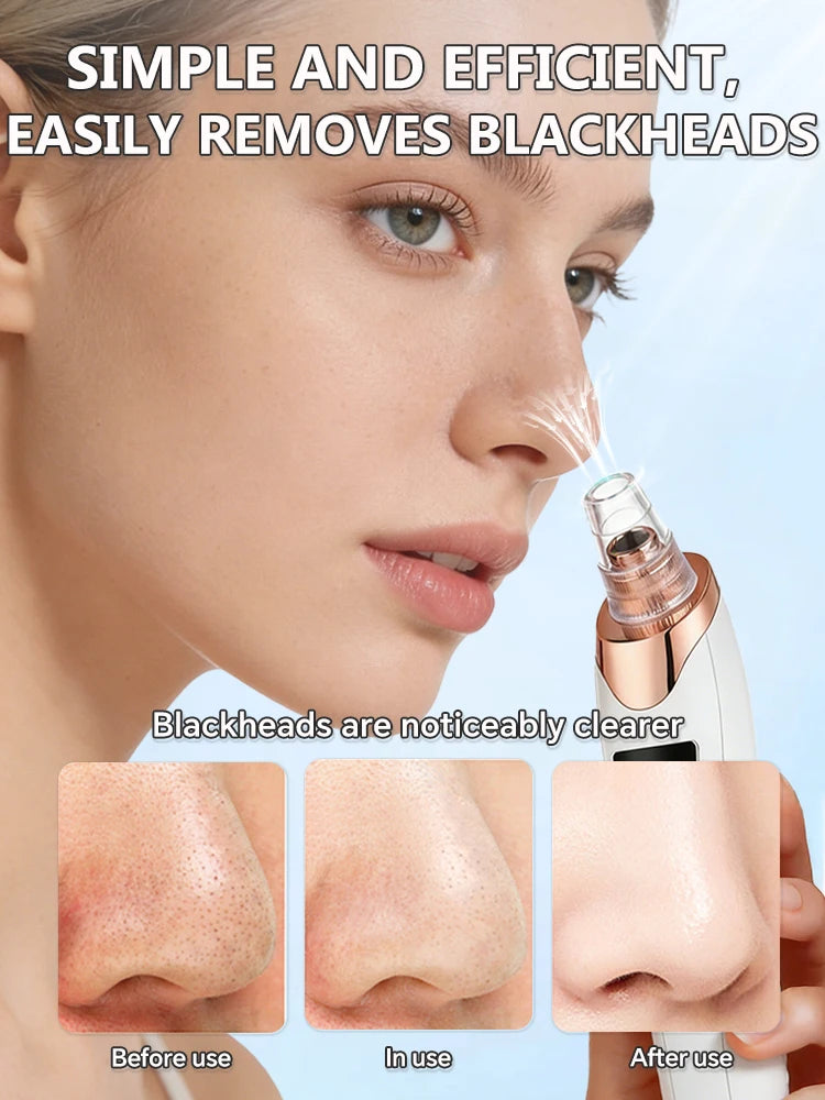 Facial Skin Care Pore Removal Cleanser Vacuum Black Spots Removal For Deep Facial Pores 5 Suction Power Blackhead Remover Pore