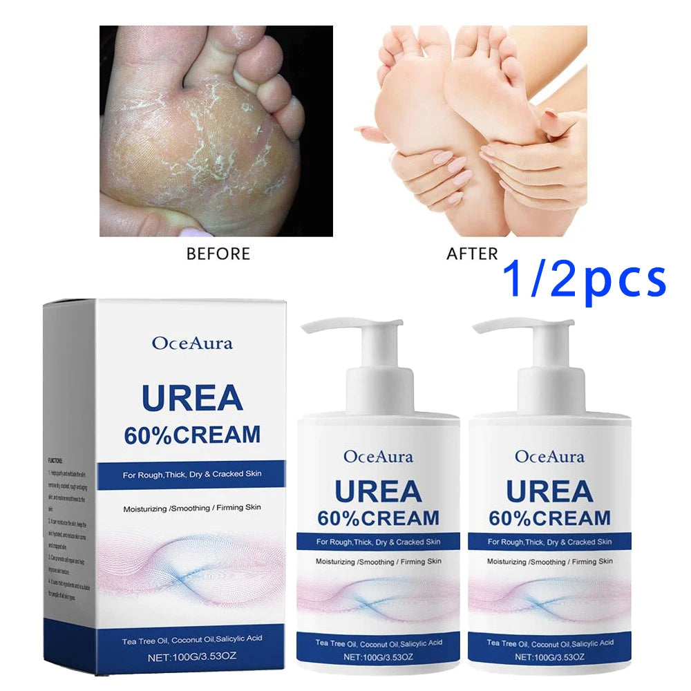 1/2pcs Urea 60% Cream Uric Acid Foot Cream for Heel Repair