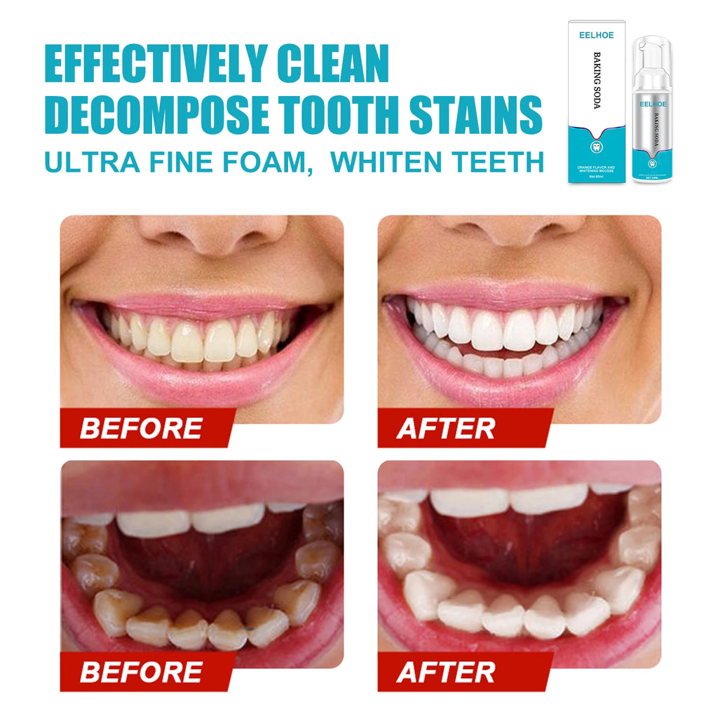 Mint Teeth Cleaning Mousse Removing Plaque Stains Breath Freshen Dental Gingival Oral Hygiene Foam Brighten Toothpaste