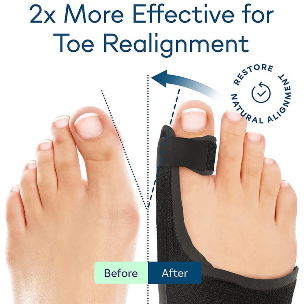Toe Corrector Orthotics Bone Thumb Adjuster Hammer Protector Hallux Valgus Corrector Bunion Corrector Orthopedic Tool Care Tools