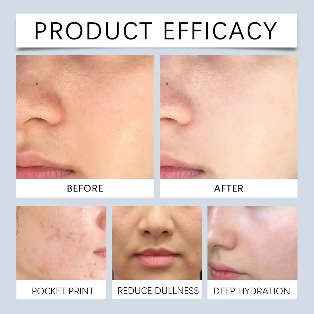 HOYGI Glycolic Acid Toning Solution To Remove Acne Moisturizing