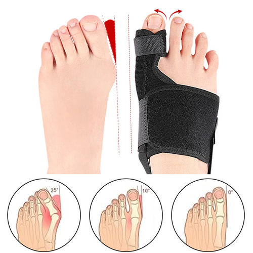 1/2PCS Bunion Corrector - Orthopedic Bunion Splint - Bunion Correction Toe Straightener with Non-slip Strap, Day Night Support