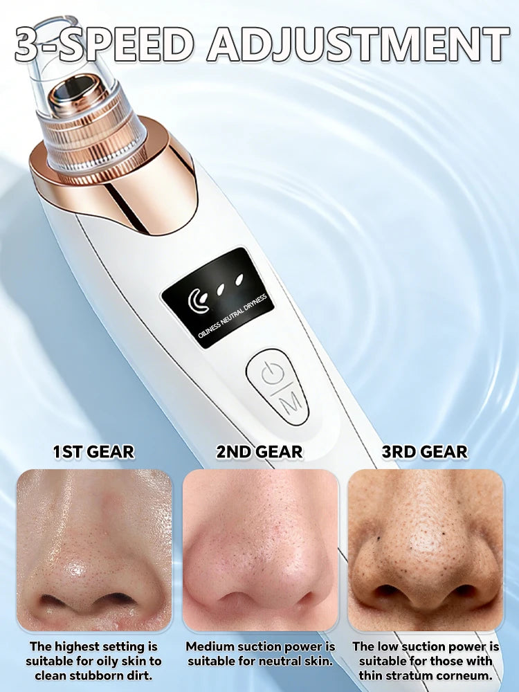 Facial Skin Care Pore Removal Cleanser Vacuum Black Spots Removal For Deep Facial Pores 5 Suction Power Blackhead Remover Pore