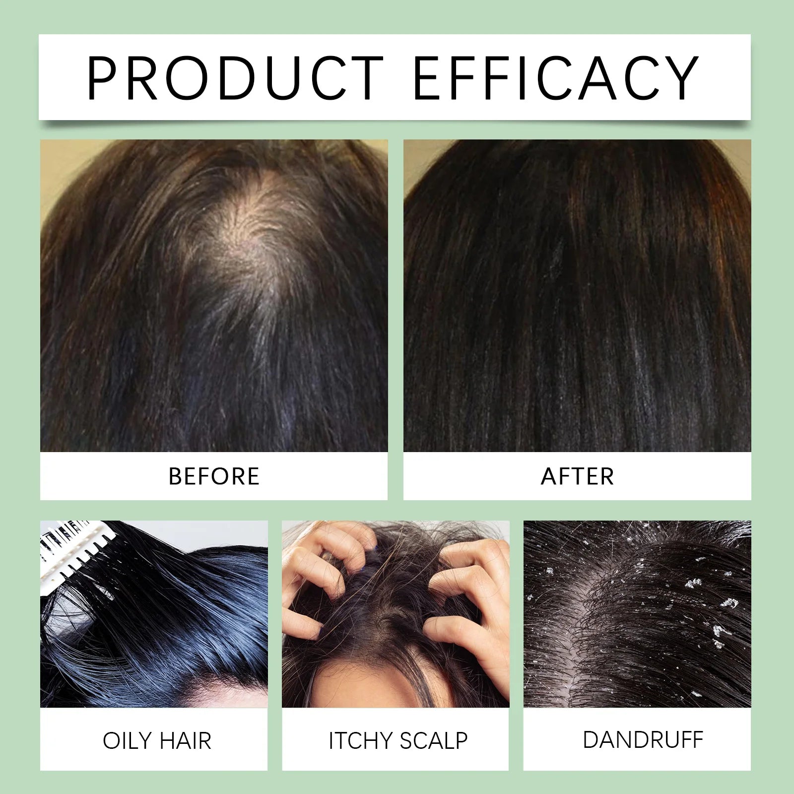 Rosemary/Ginger Scalp Exfoliaton Scrub Shampoo With Massager Comb Deep Cleaning Oil Control Relieve Itching Dandruff Removal