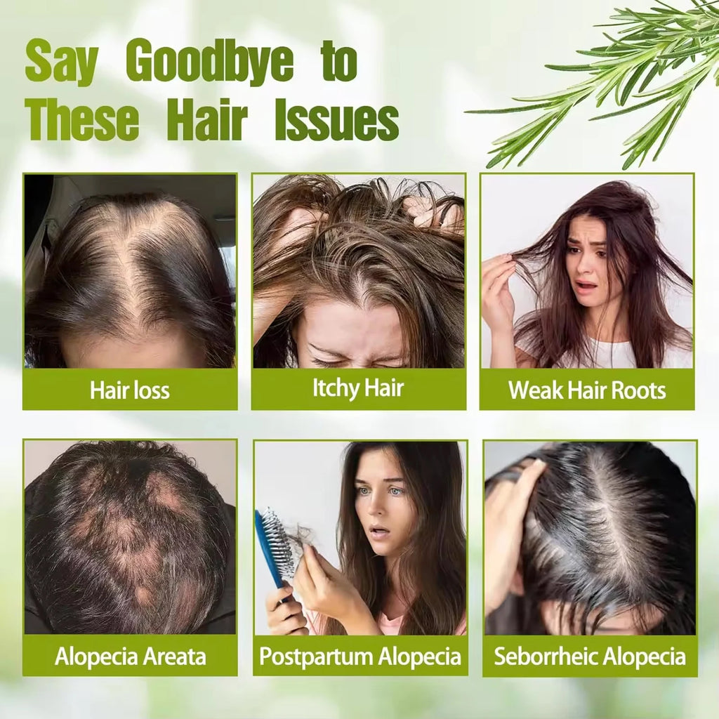 Rosemary Hair Growth Shampoo&Conditioner Set
