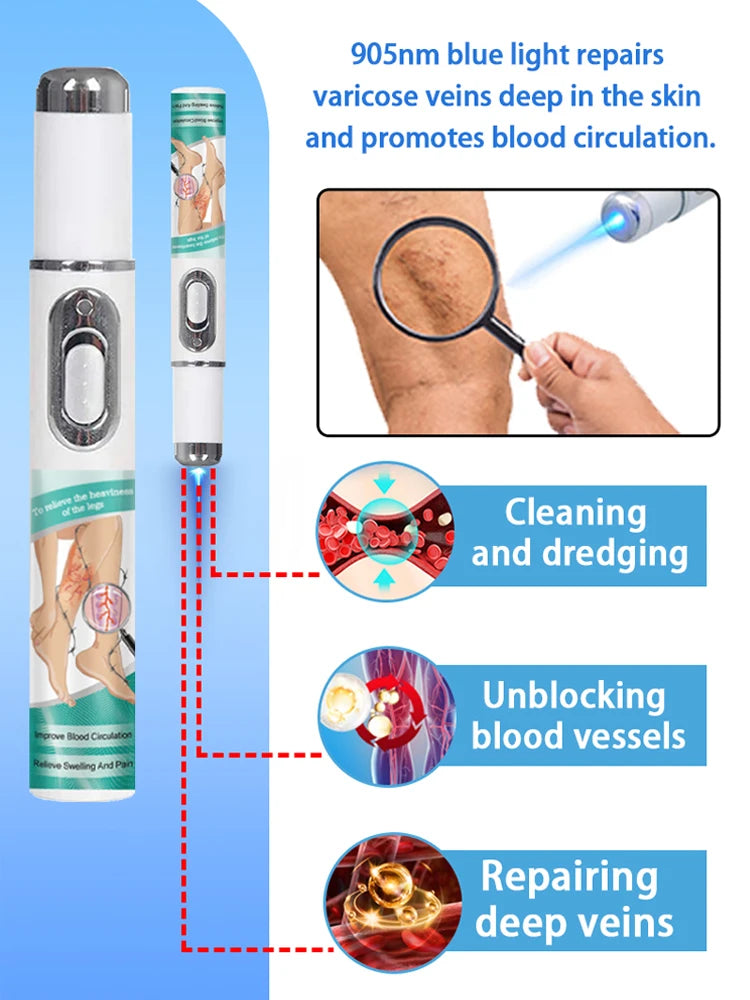 Blue Light Pen for Treating Veins in Both Legs, Vein Care Tool