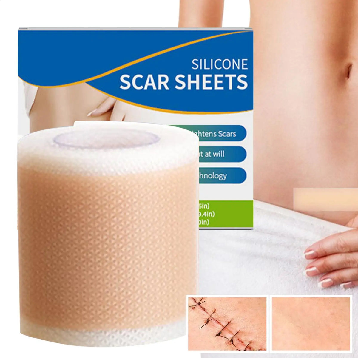 1 Roll Silicone Scar Sheets ,4cm X 50cm Silicone Scar Sheets